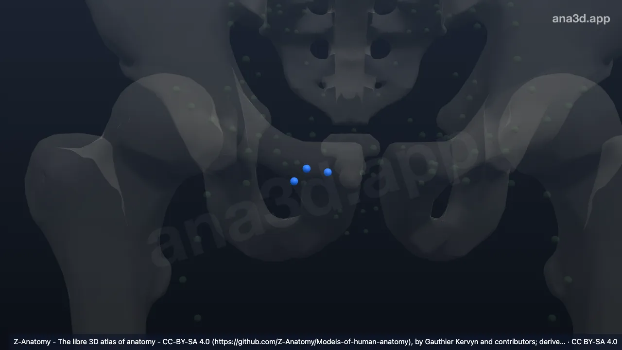 3Dモデル：右上内側浅鼠径リンパ節