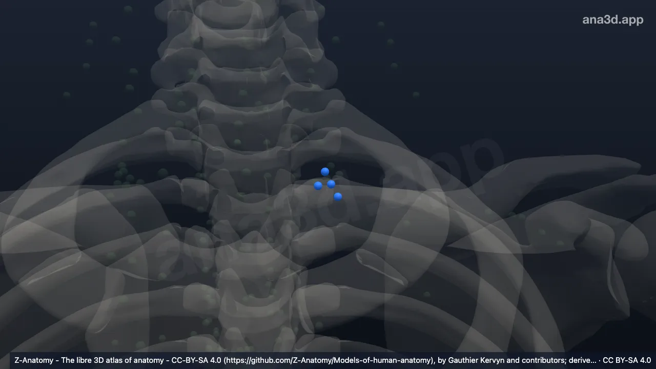 Modelo 3D: Linfonodos supraclaviculares esquerdos