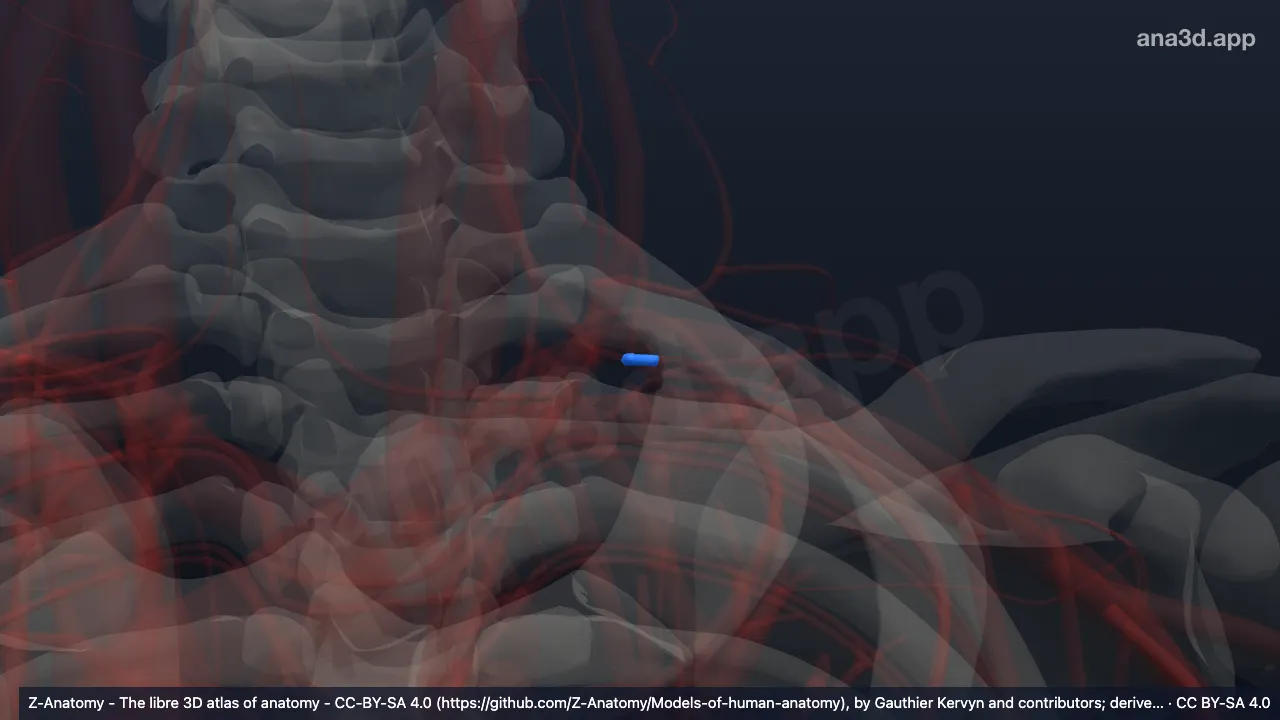 Modèle 3D : Artère intercostale suprême gauche