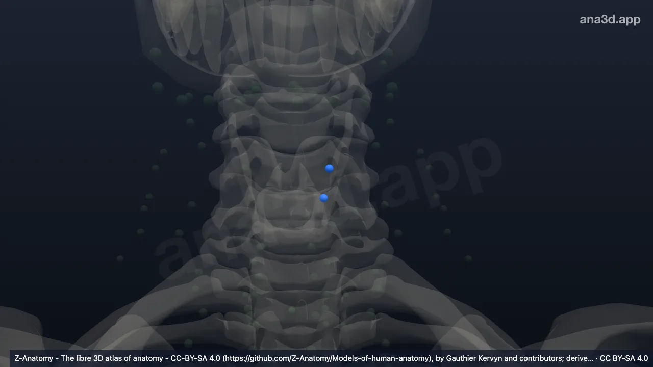 3D 模型：左甲状腺淋巴结