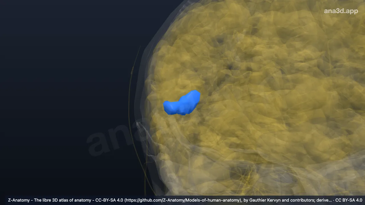 3D model: right transverse temporal gyri